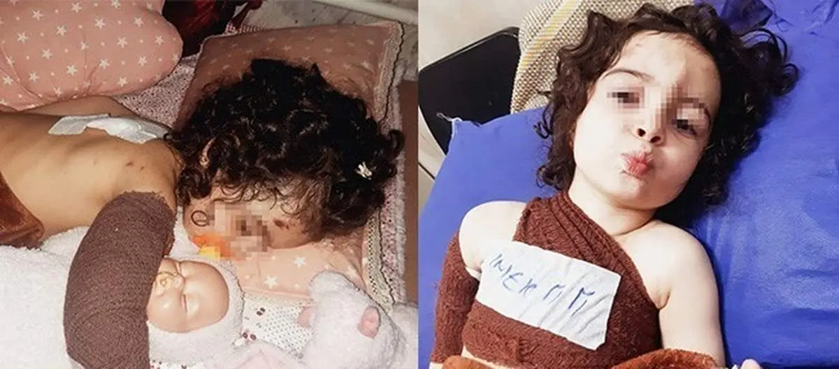 سگهای ولگرد کودک 3 ساله کرجی را دریدند!+عکس دلخراش