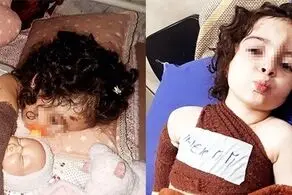 سگ‌های ولگرد کودک 3 ساله کرجی را دریدند!+عکس دلخراش