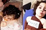 سگ‌های ولگرد کودک 3 ساله کرجی را دریدند!+عکس دلخراش