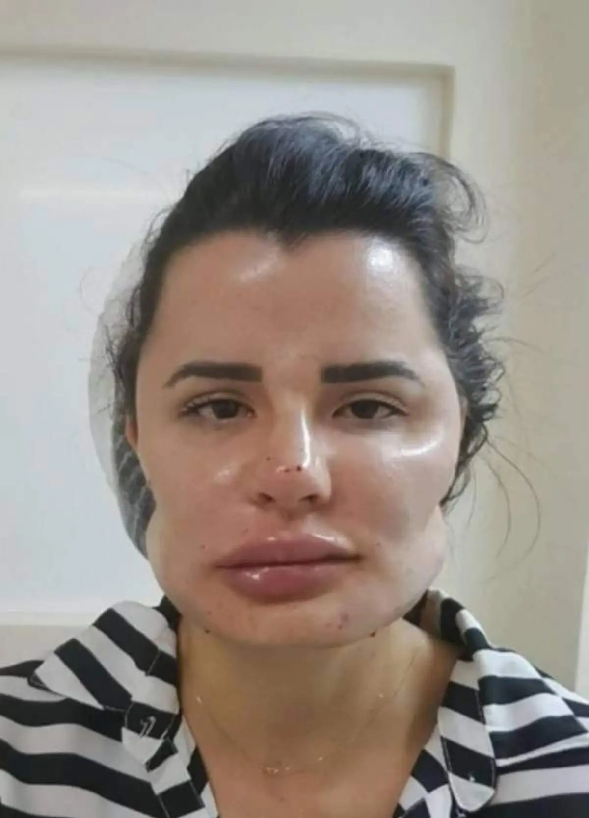 خرابکاری شرم‌آور دکتر ناشی روی صورت بیماران!+عکس