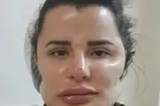 خرابکاری شرم‌آور دکتر ناشی روی صورت بیماران!+عکس