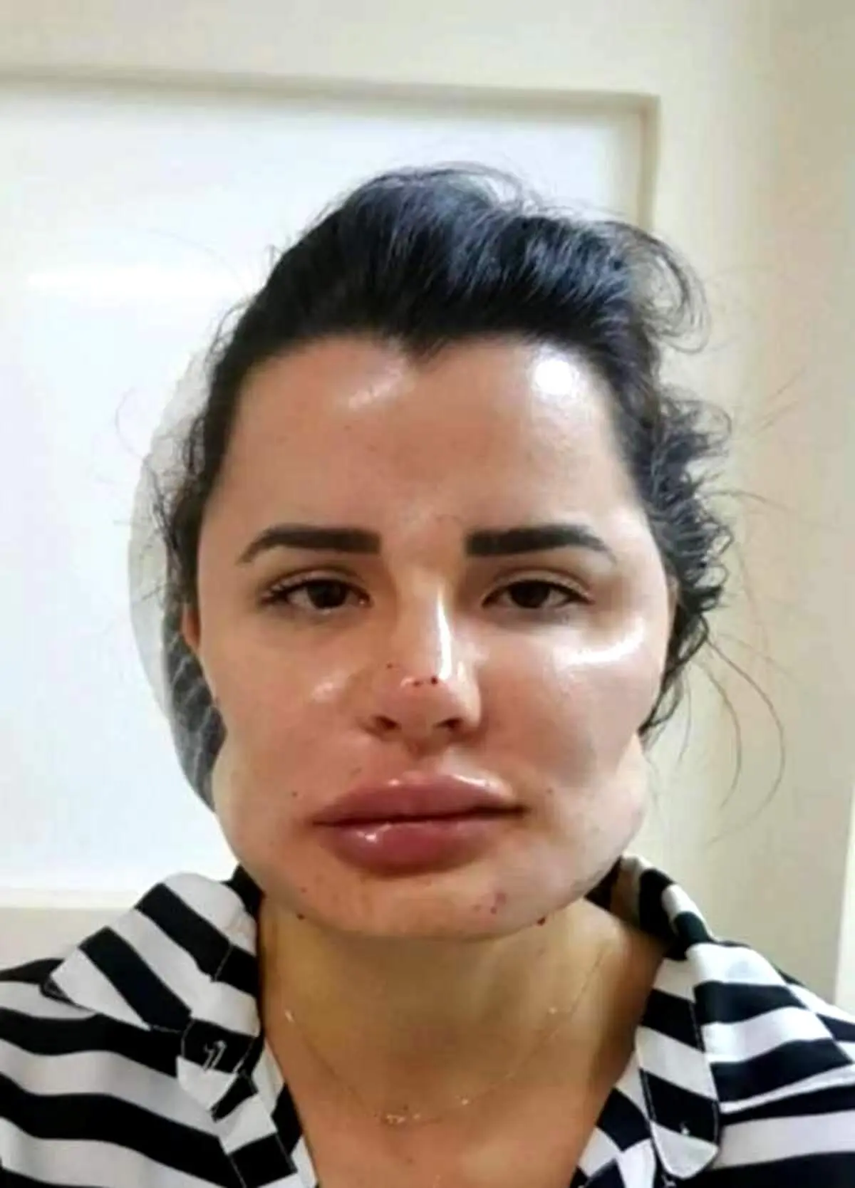 خرابکاری شرم‌آور دکتر ناشی روی صورت بیماران!+عکس