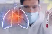 آیا ریه‌ها بدون علائم درگیر کرونا می‌شوند؟