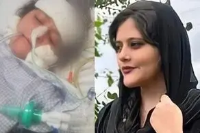 رییس پزشکی قانونی استان تهران: مهسا امینی در سال ۱۳۸۶ در یکی از بیمارستان‌های تهران جراحی مغز داشته است/هیچگونه آثاری از ضرب و جرح در ناحیه سر و صورت وجود ندارد