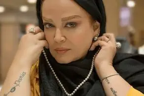 تغییر چهره عجیب بازیگر زن معروف بعد از این عمل جراحی!/ چه بلایی بر سر «بهاره رهنما» آمده است؟+عکس