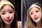100 عمل زیبایی روی صورت دختر 16 ساله!