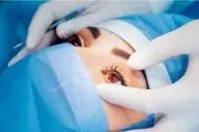 چشم های عجیب این دختر در دنیا معروف شد/ عکس