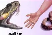 فواید عجیب زهر مار برای بدن!
