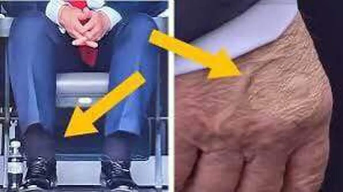 بیماری ترامپ خبرساز شد + عکس 