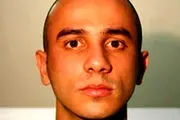 این مرد بعد مرگ سگش صورت او را به صورت خودش پیوند زد+ عکس