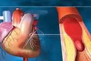 این دختر عجیب 2 قلب در سینه اش دارد+ عکس