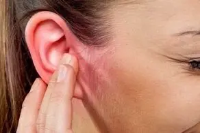 علل ابتلا به گرفتگی گوش + درمان