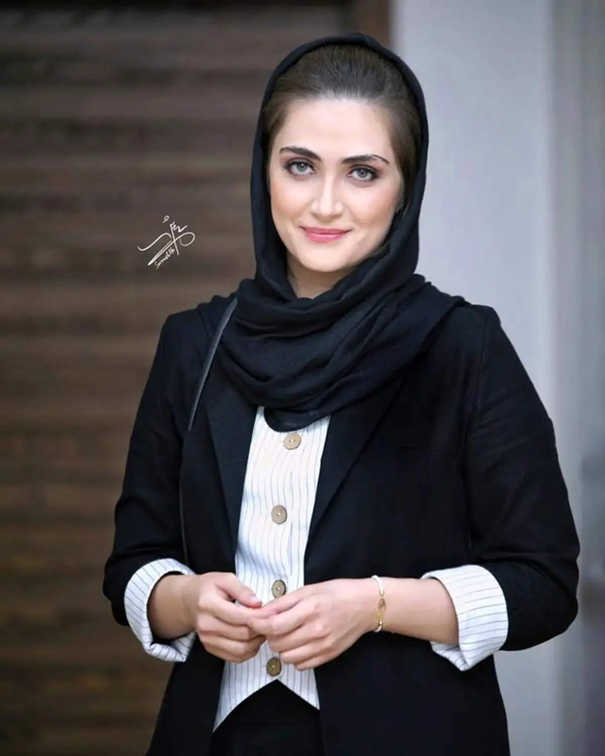 الناز ملک بازیگر سیمای زخم کاری با چهره واقعی/ عکس