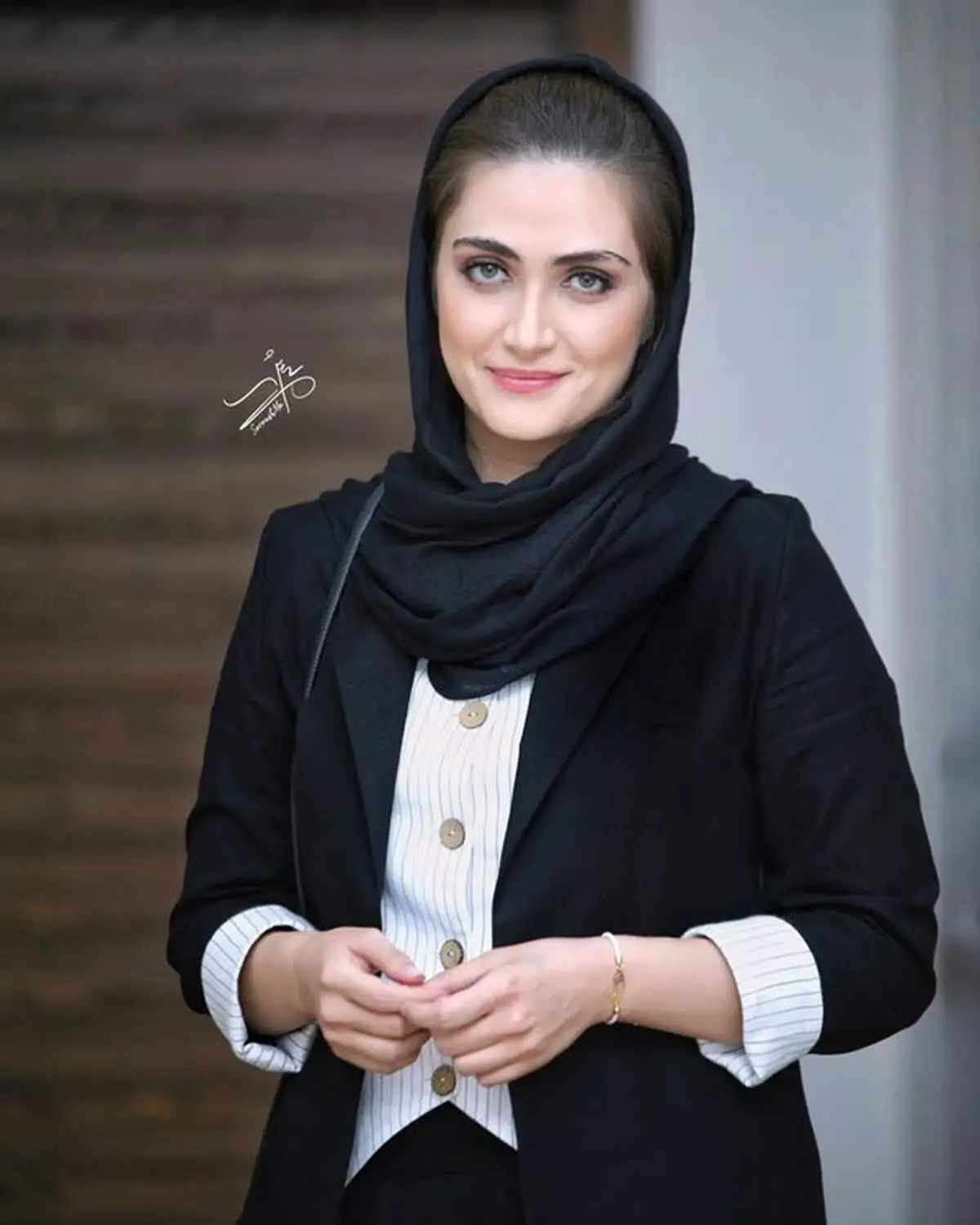 الناز ملک بازیگر سیمای زخم کاری با چهره واقعی/ عکس
