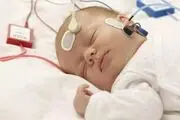 نوزاد وحشتناکی با هشت پا به دنیا آمد/ عکس