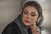عکس شوکه کننده| سرِ خانم بازیگر شکست و صورتش زخمی شد/ چه بلای بر سر «نیوشا ضیغمی» آورده‌اند؟