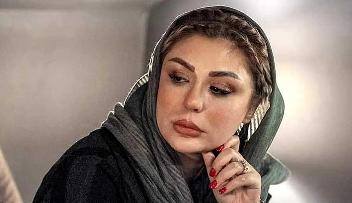 عکس شوکه کننده| سرِ خانم بازیگر شکست و صورتش زخمی شد/ چه بلای بر سر «نیوشا ضیغمی» آورده‌اند؟