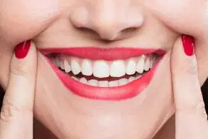 خنده‌ی زشت خواهر زن به بیماری داماد خانواده