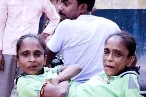 ازدواج خواهران بهم چسبیده با یک مرد!+عکس