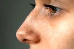 قوز بینی، ترند تازه زیبایی ۲۰۲۶ شد!