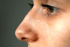 قوز بینی، ترند تازه زیبایی ۲۰۲۶ شد!