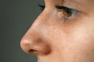 قوز بینی، ترند تازه زیبایی ۲۰۲۶ شد!