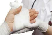 راهنمای رسیدگی فوری به سوختگی