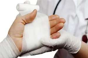 راهنمای رسیدگی فوری به سوختگی