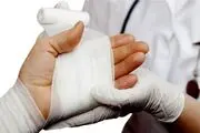 راهنمای رسیدگی فوری به سوختگی