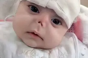 موش دماغ این نوزاد زیبا را خوردند!+عکس دلخراش
