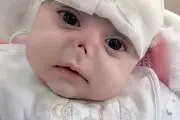 موش دماغ این نوزاد زیبا را خوردند!+عکس دلخراش