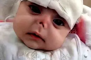 موش دماغ این نوزاد زیبا را خوردند!+عکس دلخراش