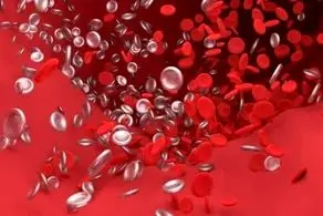 ایجاد لخته‌ خون در مبتلایان به کرونا