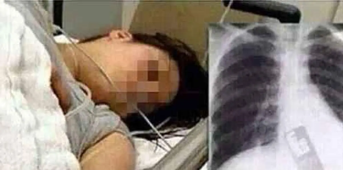 این دختر از ترس گوشی موبایلش را قورت داد!+ عکس