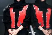 الناز حبیبی در ۱۹ سالگی وقتی بینی اش را عمل نکرده بود/ عکس