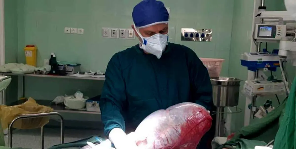 وجود یک غده 8 کیلویی در شکم این نوجوان ۱۳ ساله!/این دختر باردار نیست!+عکس