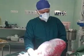 وجود یک غده 8 کیلویی در شکم این نوجوان ۱۳ ساله!/این دختر باردار نیست!+عکس