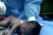 نوزاد تَر و فِرز چهار دست و پا از شکم مادرش خارج شد !+ عکس