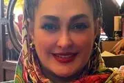عکس جنجالی| کتک خوردن شدید خانم بازیگر معروف در جشنواره فیلم فجر!/ چه بلایی بر سر الهام حمیدی آمده است؟