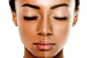 راهکارهای ساده و فوری برای روشن کردن رنگ پوست