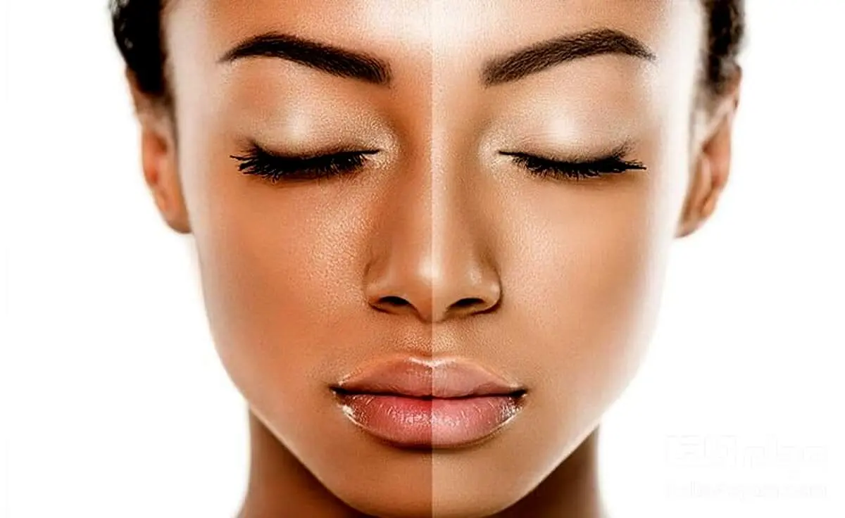 راهکارهای ساده و فوری برای روشن کردن رنگ پوست