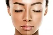 راهکارهای ساده و فوری برای روشن کردن رنگ پوست