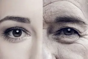 این پیرزن فقط 26 سال سن دارد/ عکس