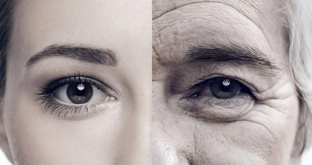 این پیرزن فقط 26 سال سن دارد/ عکس