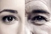 این پیرزن فقط 26 سال سن دارد/ عکس