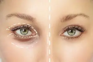 وحشتناک‌ترین زن جهان که حاضر به جراحی چهره خود نیست / عکس