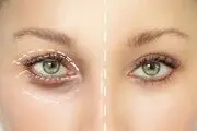 وحشتناک‌ترین زن جهان که حاضر به جراحی چهره خود نیست / عکس