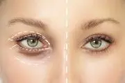 وحشتناک‌ترین زن جهان که حاضر به جراحی چهره خود نیست / عکس