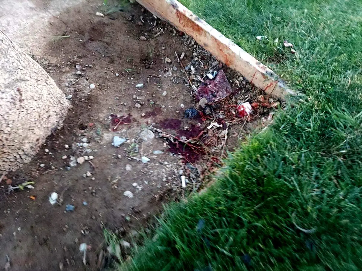 جسد تکه تکه شده این زن در میدان آزادی کشف شد+عکس 