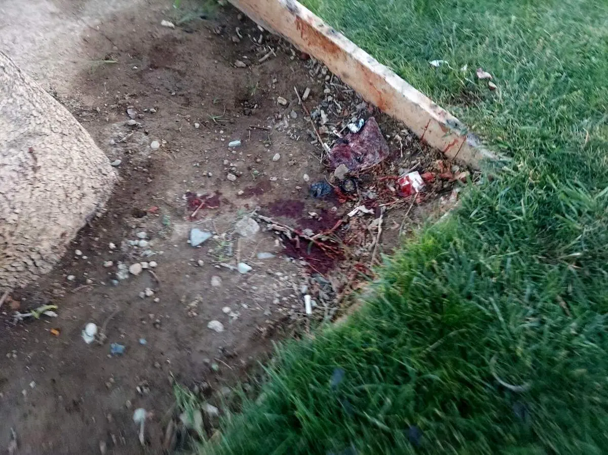 جسد تکه تکه شده این زن در میدان آزادی کشف شد+عکس 